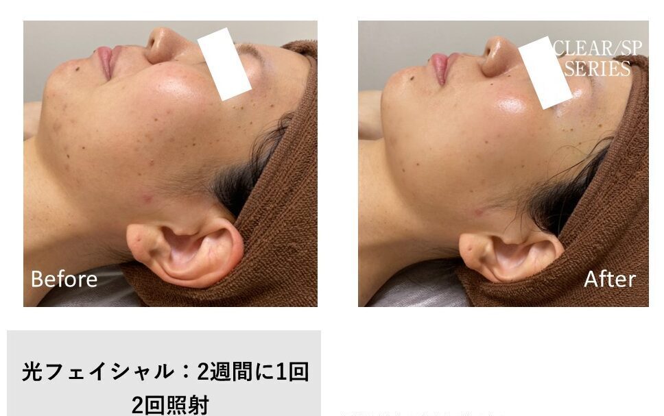※感じ方や仕上がりには個人差があります。